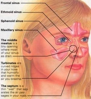 Sinusitis Los Angeles