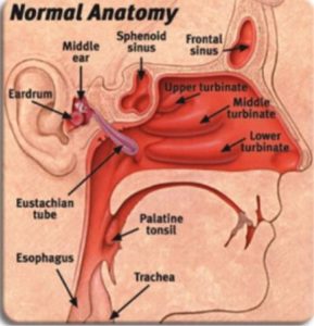 Eustachian Tube Dysfunction Los Angeles