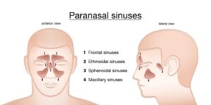 Paranasal Sinuses