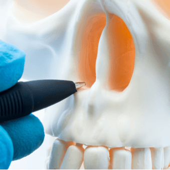 Deviated Septum Repair<br />
(Septoplasty) Los Angeles, CA