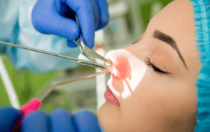 Sinus Surgery female patient