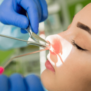 Sinus Surgery female patient