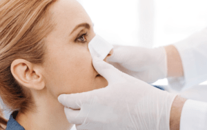Surgical septoplasty Los Angeles