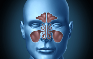 sinus doctors in Los Angeles