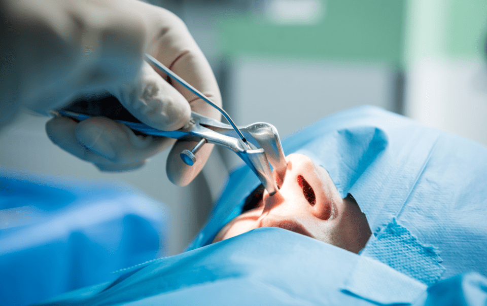 sinus surgery