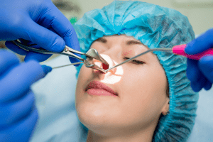 sinus surgery