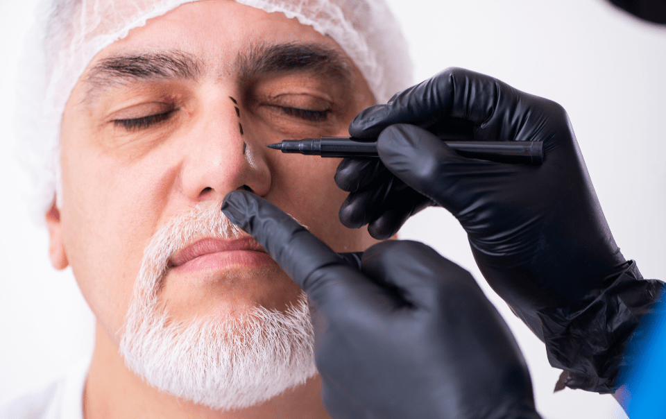 Septoplasty Recovery Time: What to  Expect After Surgery