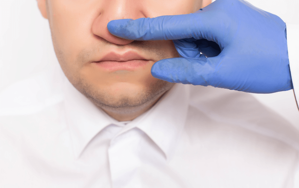 Is Your Septoplasty Covered? A Guide to Understanding Insurance  Policies