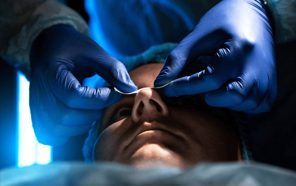 Selecting the Right Surgeon for Septoplasty: Key Considerations