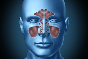 sinus treatment