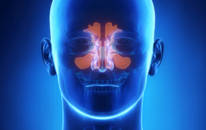 Preventing Recurrent Sinus Infections
