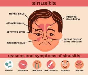 sinusitis treatment Los Angeles
