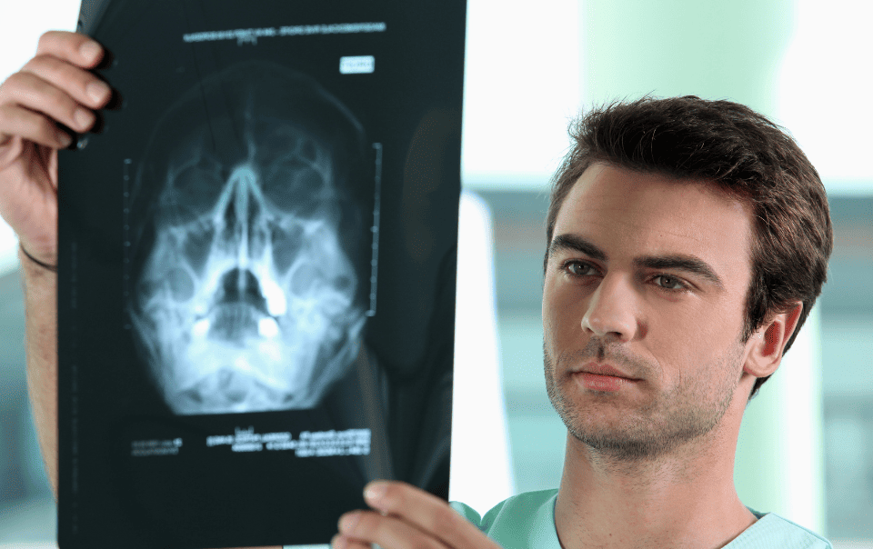 Sinus Cysts: Do You Need Surgery or Can They Go Away on Their Own?