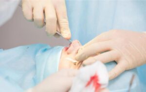 Patient receiving postoperative nasal care after deviated septum surgery, illustrating follow-up care and the recovery process after septal surgery